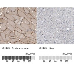 Desmoglein-2 Antibody, Novus Biologicals:Antibodies:Primary Antibodies
